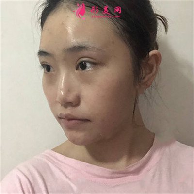 1289c4a60b4d-half.jpg