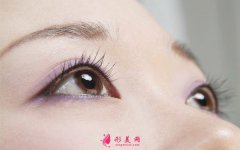 雙眼皮手術(shù)了修復(fù)難度大嗎？