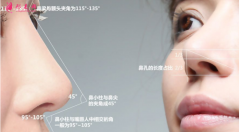 假體隆鼻以后還需要更換嗎？