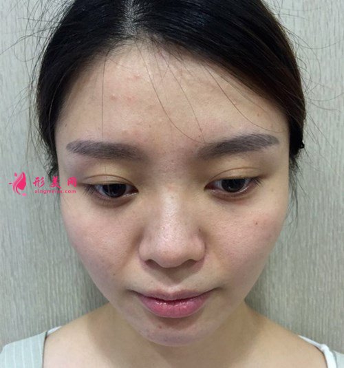 案例5.jpg 案例5.jpg