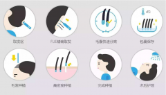 什么是FUT植發(fā)技術(shù)和FUE植發(fā)技術(shù)？有什么區(qū)別?