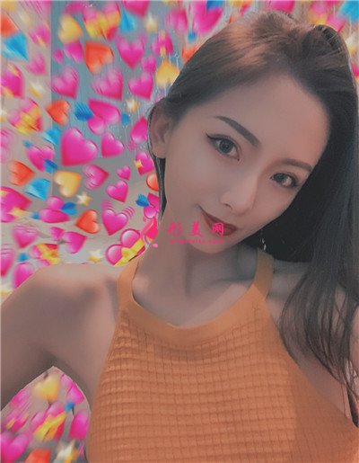 長沙小仙女肋軟骨隆鼻術后效果分享 術后 長沙小仙女肋軟骨隆鼻術后效果分享