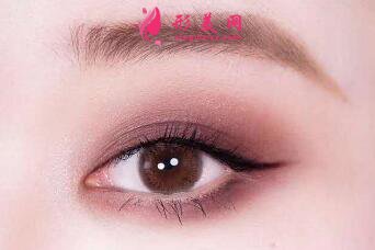 開(kāi)眼角手術(shù)需要的費(fèi)用是多少