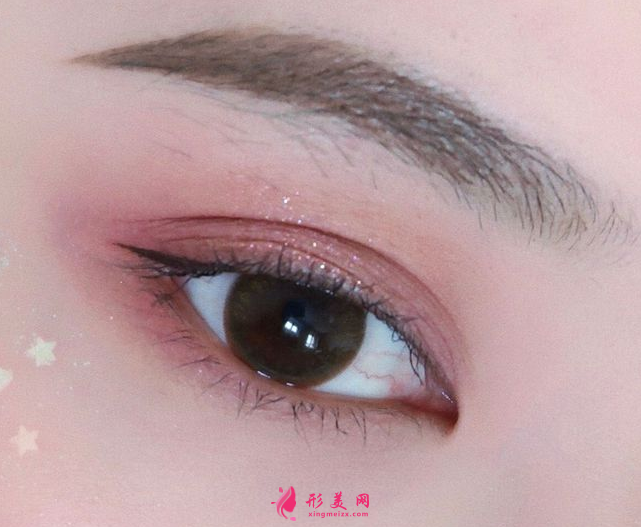 雙眼皮手術(shù)哪里做得好