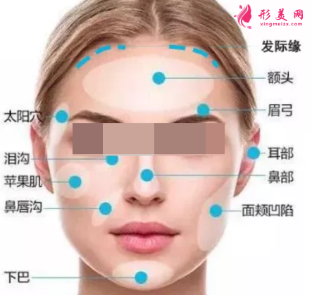 自體脂肪填充面部需要注射多少次
