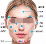 自體脂肪填充臉部效果自然嗎？