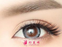 割雙眼皮有風(fēng)險嗎？重慶聯(lián)合麗格割雙眼皮多少錢？