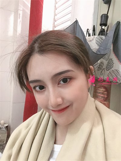 杭州小仙女齊全雙眼皮術(shù)后恢復(fù)情況對(duì)比 術(shù)后 杭州小仙女齊全雙眼皮術(shù)后恢復(fù)情況對(duì)比
