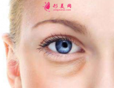 手術(shù)祛眼袋會(huì)不會(huì)有什么風(fēng)險(xiǎn)？