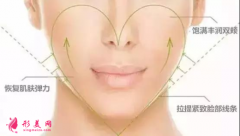 自體脂肪填充面部多久可以洗臉