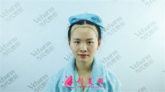 重慶當代整形種植發(fā)際線手術(shù)術(shù)后效果反饋