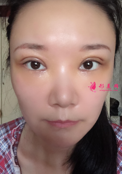 1597133416104910.png TIM截圖20200811160455_resized.png