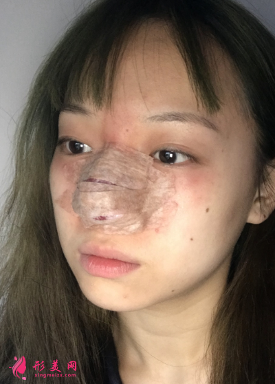 1597217665128415.png TIM截圖20200812150648_resized.png