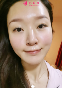 想要變白去皺滿臉膠原蛋白？西京醫(yī)院熱瑪吉統(tǒng)統(tǒng)實(shí)現(xiàn)
