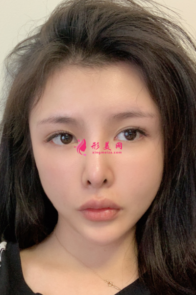 1597219521798345.png TIM截圖20200812160145_resized.png