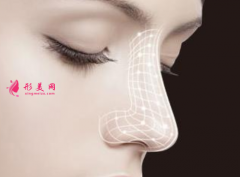 假體隆鼻術(shù)后會留下疤痕嗎？