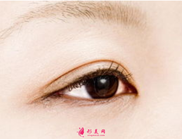 雙眼皮手術(shù)失敗多久可以修復(fù)