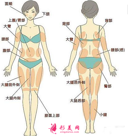 吸脂減肥的價(jià)格要多少錢