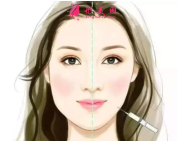 瘦臉針打了有用嗎