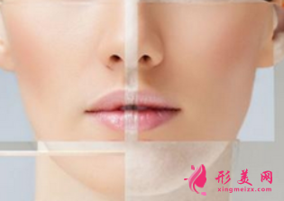 激光祛斑常見的風(fēng)險(xiǎn)有哪些