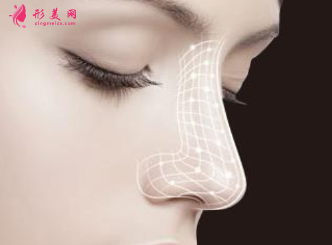 膨體隆鼻術(shù)后手感怎么樣