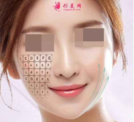 激光除皺一般需要多少錢
