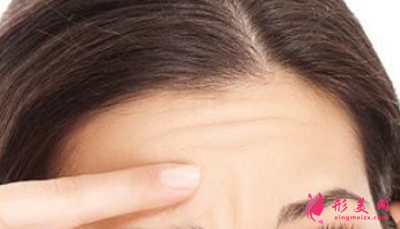 激光除皺一般需要多少錢