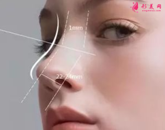 自體軟骨隆鼻整形有什么優(yōu)點(diǎn)