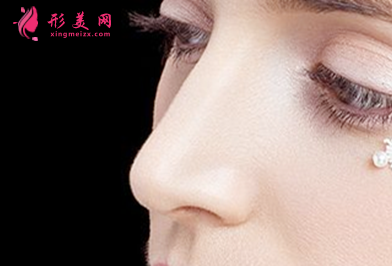 自體軟骨隆鼻整形有什么優(yōu)點(diǎn)