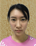 武漢美基元醫(yī)療美容醫(yī)院汪洋祛眼袋怎么樣？