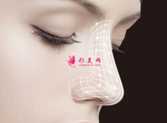 肋軟骨隆鼻一般要多少錢？