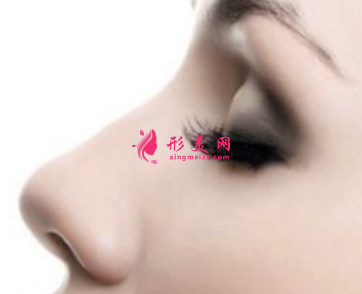假體隆鼻一般什么時候消腫