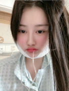 四川友誼醫(yī)院下頜角手術(shù)怎么樣？術(shù)后臉整個小了一圈！