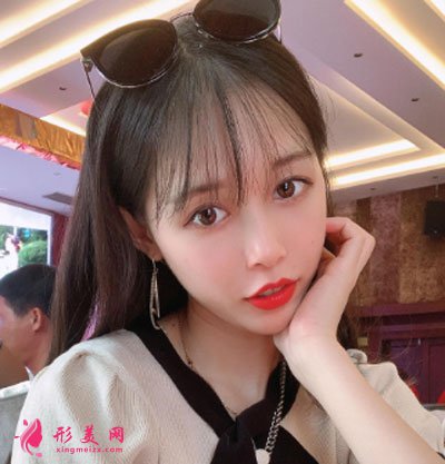 上海華美做熱瑪吉怎么樣？術(shù)后三個(gè)月皮膚變得緊致了