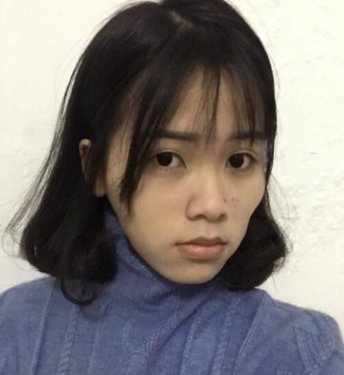 上海九院顴骨內(nèi)推多少錢？全新價格表來襲！附案例分享