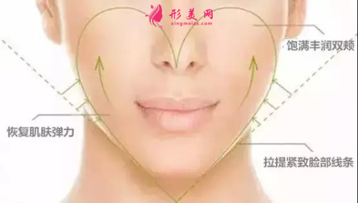 自體脂肪填充臉部后可以保持多久