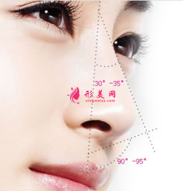 自體軟骨隆鼻術(shù)后注意事項有哪些