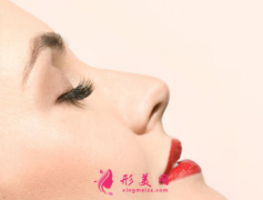 自體軟骨隆鼻效果可以長久保持嗎？