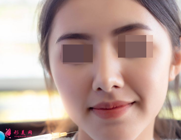 自體脂肪填充面部后顯得有些臃腫怎么辦