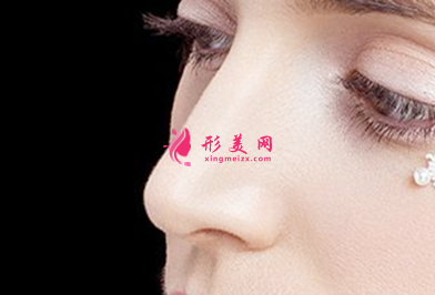 自體軟骨隆鼻能保持多久時(shí)間