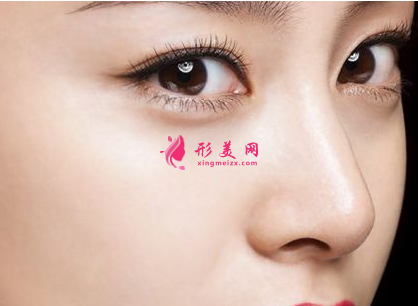 自體軟骨隆鼻能保持多久時(shí)間