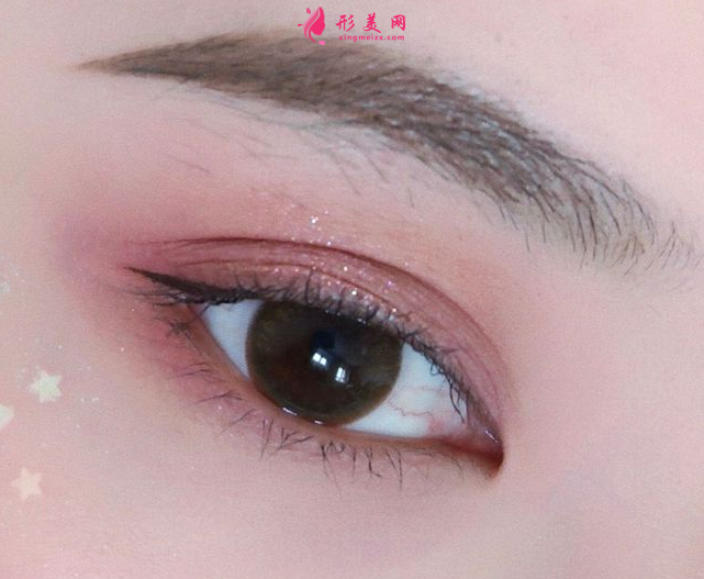 雙眼皮術(shù)后的護(hù)理如何做