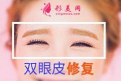 長沙雅美整形醫(yī)院做雙眼皮修復(fù)怎么樣？