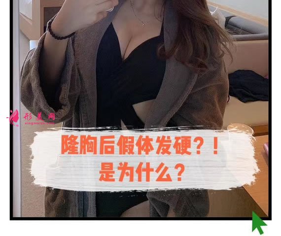 假體隆胸術(shù)后假體發(fā)硬怎么辦.jpg 假體隆胸術(shù)后假體發(fā)硬怎么辦.jpg