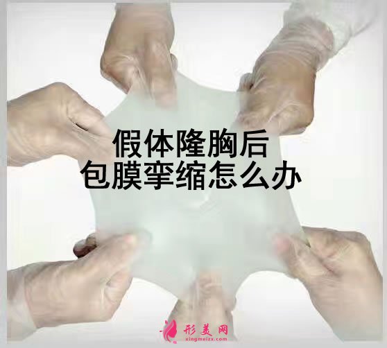 假體隆胸后包膜攣縮怎么辦.jpg 假體隆胸后包膜攣縮怎么辦.jpg
