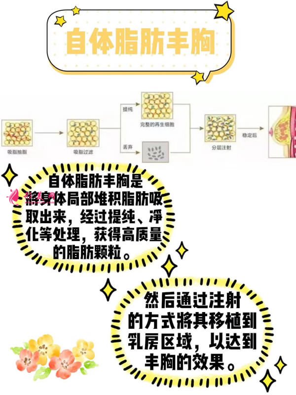 自體脂肪豐胸過程圖.jpg 自體脂肪豐胸過程圖.jpg