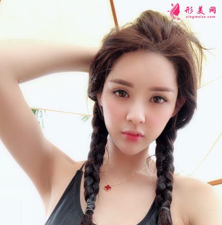 重慶星榮整形外科醫(yī)院隆鼻案例~價(jià)格表2021整形報(bào)價(jià)大全