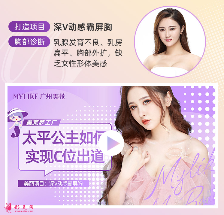 廣州美萊深V動感霸屏胸案例圖.png
