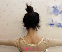 西安同濟(jì)整形美容科吸脂怎么樣？案例效果圖+2021價(jià)格(價(jià)目)表