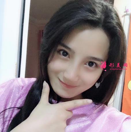 鄭州大學(xué)第一附屬醫(yī)院整形科怎么樣？隆鼻價(jià)格及恢復(fù)效果展示